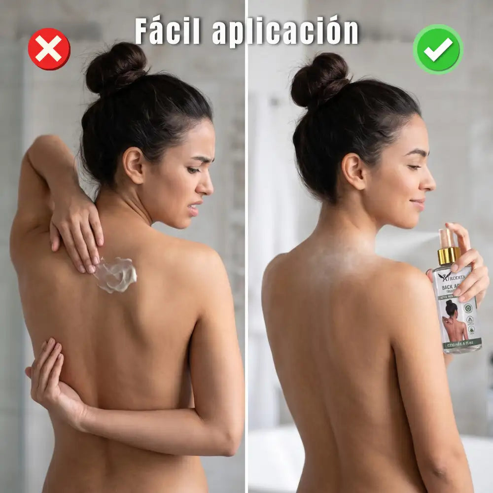 Spray Corporal para Acné y Foliculitis