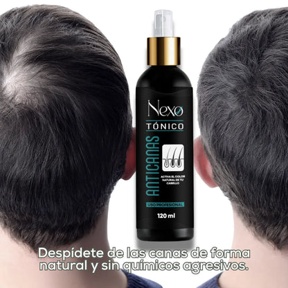 Tónico Anticanas Premium | Reactiva tu Color Natural desde la Raíz