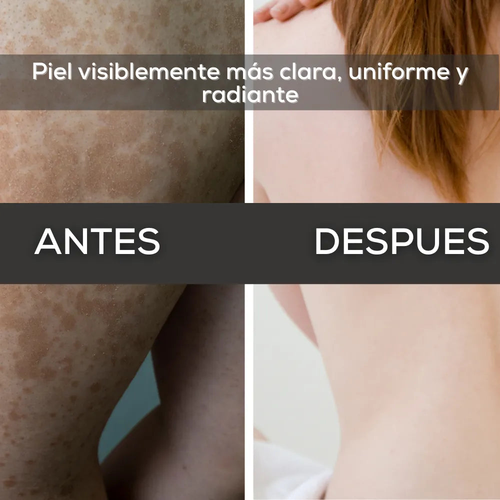 Gel Aclarante y Unificador | Dile adiós a manchas y tono desigual