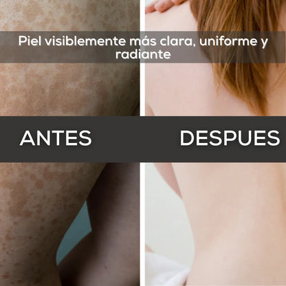 Gel Aclarante y Unificador | Dile adiós a manchas y tono desigual