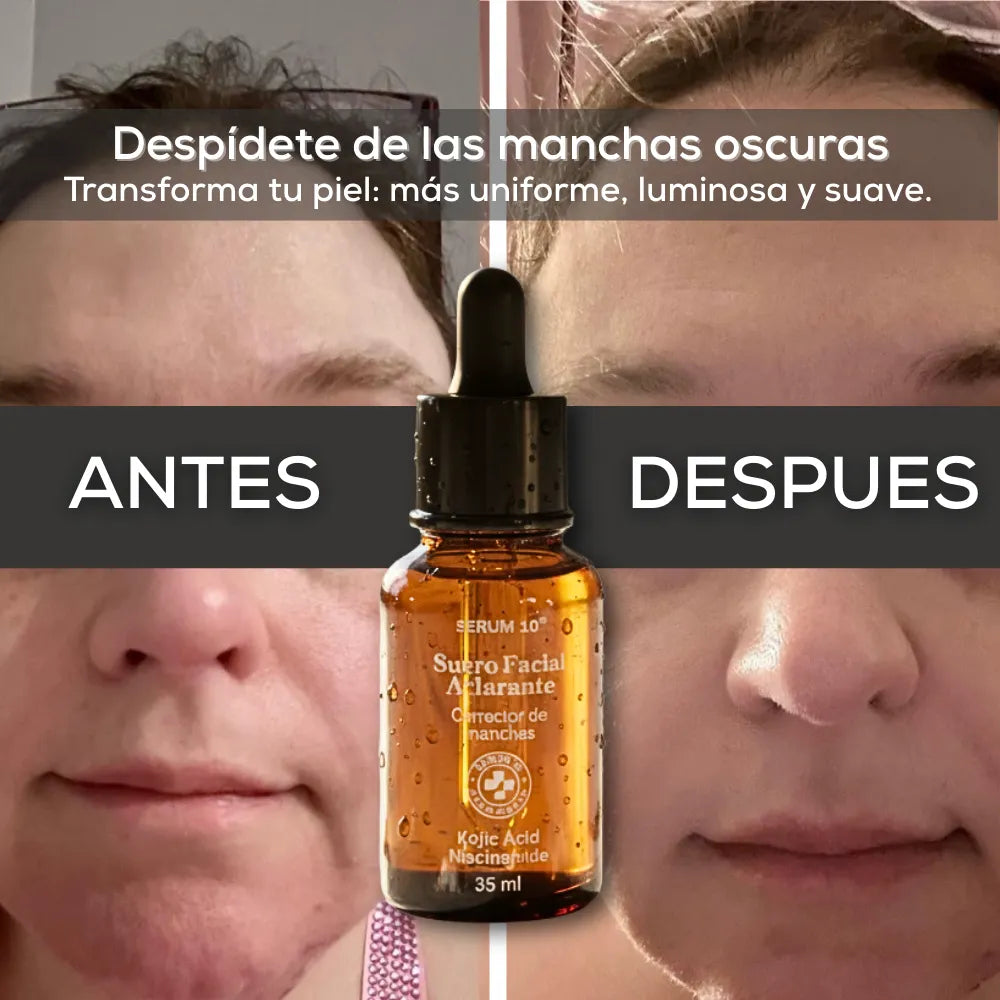 Serum KOJIC+ | Ilumina tu piel y borra manchas desde la raíz