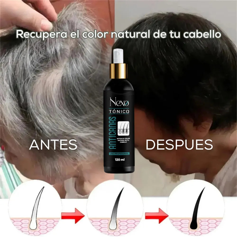 Tónico Anticanas Premium | Reactiva tu Color Natural desde la Raíz