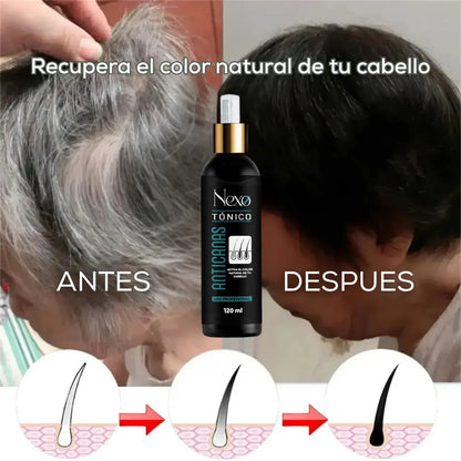 Tónico Anticanas Premium | Reactiva tu Color Natural desde la Raíz