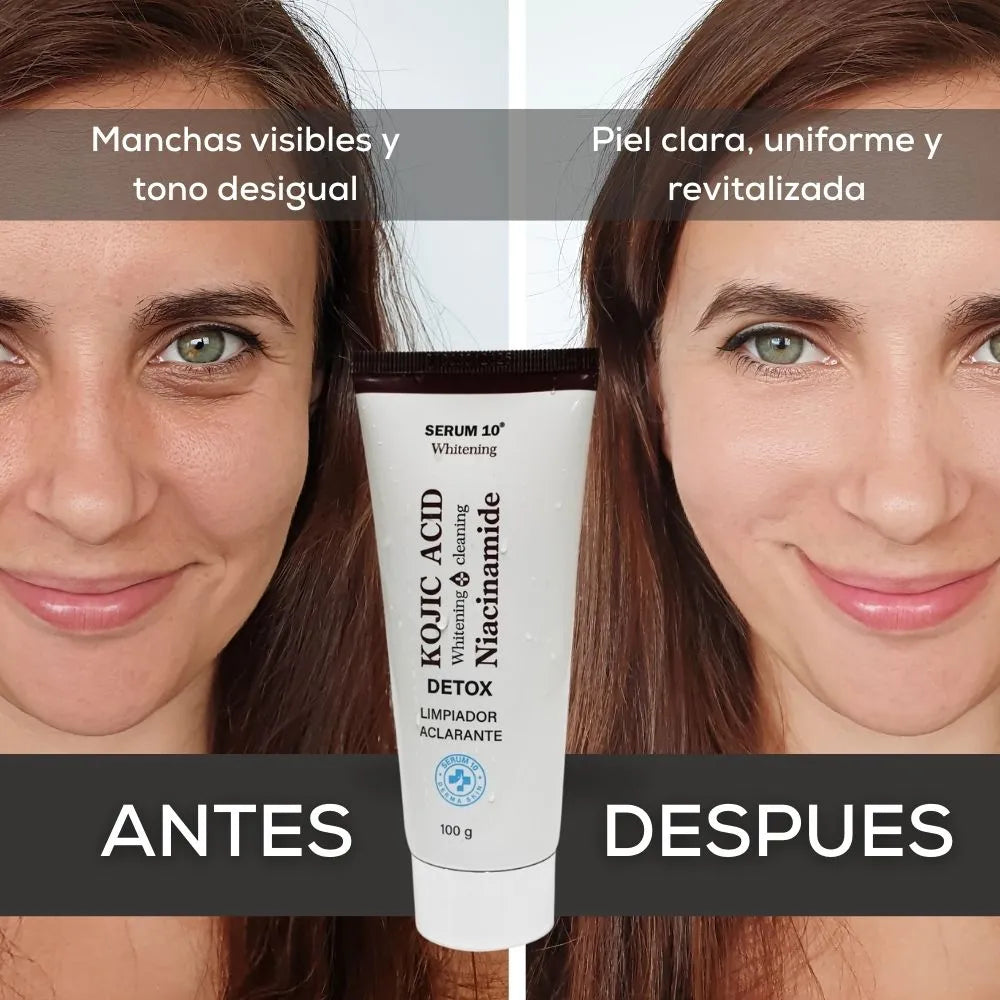 Jabón Facial Kojic+ Aclarante