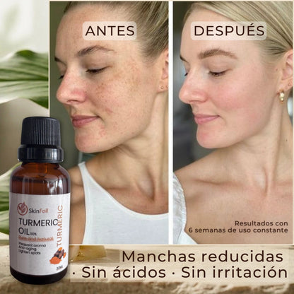 Serum Cúrcuma · Calma y Unifica el Tono de la Piel